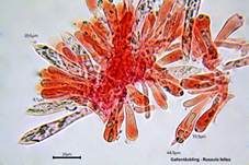 Gallentäubling, Foto 21