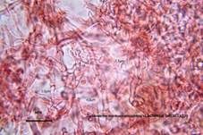 Gebänderter Hainbuchenmilchling, Foto 45