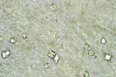 Gelbblättriger Schirmling, Foto 29