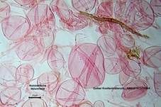 Gelber Knollenblätterpilz, Foto 91