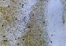Gelbrandiger Mürbling, Foto 11