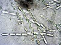 Gelbverfarbender Kernpilz, Foto 9