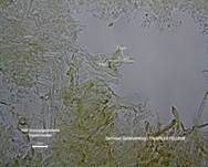 Gemeiner Gallenröhrling, Foto 45