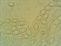 Gemeiner Sandborstling, Foto 25
