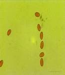 Gold-Mistpilz, Foto 35