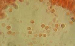 Grauer Adermoosling, Foto 10