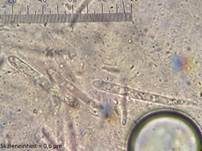 Graugelber Proliferodiscus, Foto 23