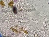 Graugelber Proliferodiscus, Foto 24