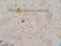 Graugelber Proliferodiscus, Foto 26