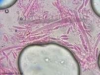 Graugelber Proliferodiscus, Foto 27