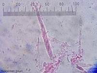 Graugelber Proliferodiscus, Foto 28
