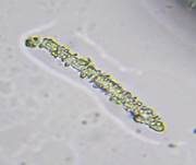 Graugelber Proliferodiscus, Foto 29