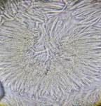 Graugelber Proliferodiscus, Foto 30