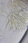 Graugelber Proliferodiscus, Foto 35