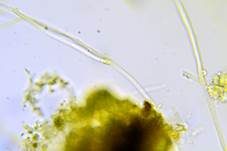 Große Algenspinne, Foto 14