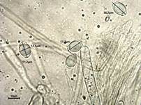 Grubenlorchel, Foto 43