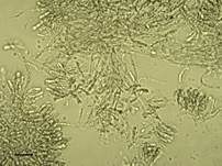 Grüner Anistrichterling, Foto 37