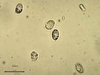 Grüner Anistrichterling, Foto 40