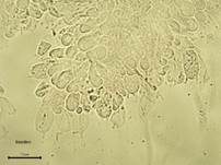 Grüner Knollenblätterpilz, Foto 106