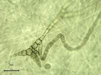 Grüner Knollenblätterpilz, Foto 109
