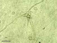 Grüner Knollenblätterpilz, Foto 111