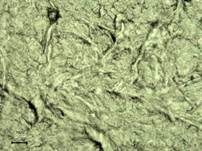 Grüner Knollenblätterpilz, Foto 113