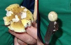 Grüner Knollenblätterpilz, Foto 91