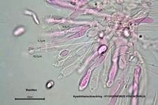 Hyazinthenschneckling, Foto 12