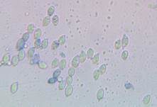 Hygrophaner Rasling, Foto 19