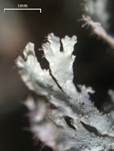 Insidien-Napfflechte, Foto 13