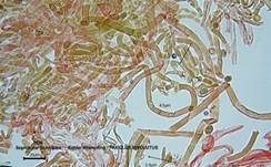 Kahler Krempling, Foto 36