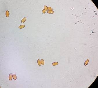 Kegelhütiges Samthäubchen - Sektion JUNIANA, Foto 6