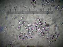 Langstielige Becherlorchel, Foto 34