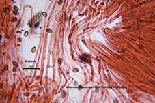 Bitterster Schleimfuß, Foto 16
