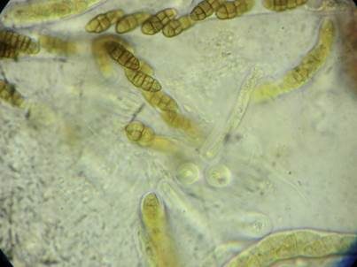 Mauersporiger Robinienkernpilz, Foto 3