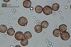 Münzförmiges Stielbecherchen, Foto 7