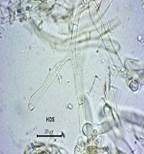 Blasser Adermoosling, Foto 22