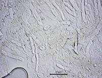 Blasser Adermoosling, Foto 26