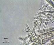Ockerrötlicher Resupinatstacheling, Foto 24