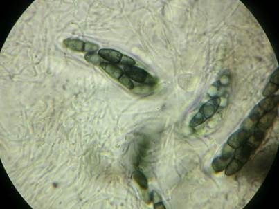 Aethiops'cher Kirschstein-Kugelpilz, Foto 3