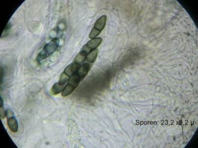 Aethiops'cher Kirschstein-Kugelpilz, Foto 4