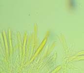 Blassgoldenes Spinnwebbecherchen, Foto 14
