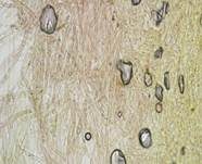 Pantherchampignon, Foto 16