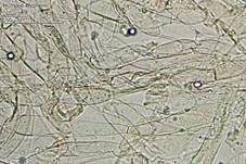Pfifferlingsähnlicher Saftling, Foto 20