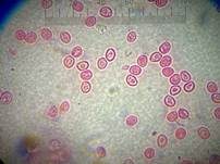 Pflaumen-Feuerschwamm, Foto 34