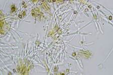 Pilz-Stecknadelflechte, Foto 6
