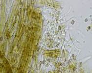 Pilz-Stecknadelflechte, Foto 9
