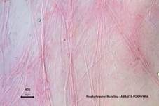 Porphyrbrauner Wulstling, Foto 49
