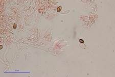 Psilocybin-Trüffel, Foto 20