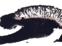 Raue Kugelflechte, Foto 12
